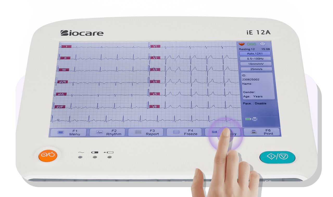 Biocare Digital 12Lead EKG/ECG Machine with Automatic Interpretation, 12Channel for Fast and